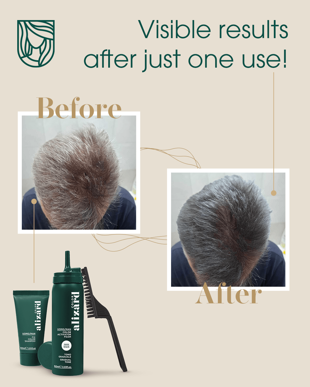 Alizard Color Set for Brown Hair (Color Activator Foam + Color Fixer) - My Hair Science