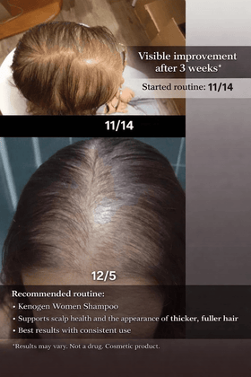 Scalp Health and Fuller-Looking Hair: A Practical Guide for Women - My Hair Science