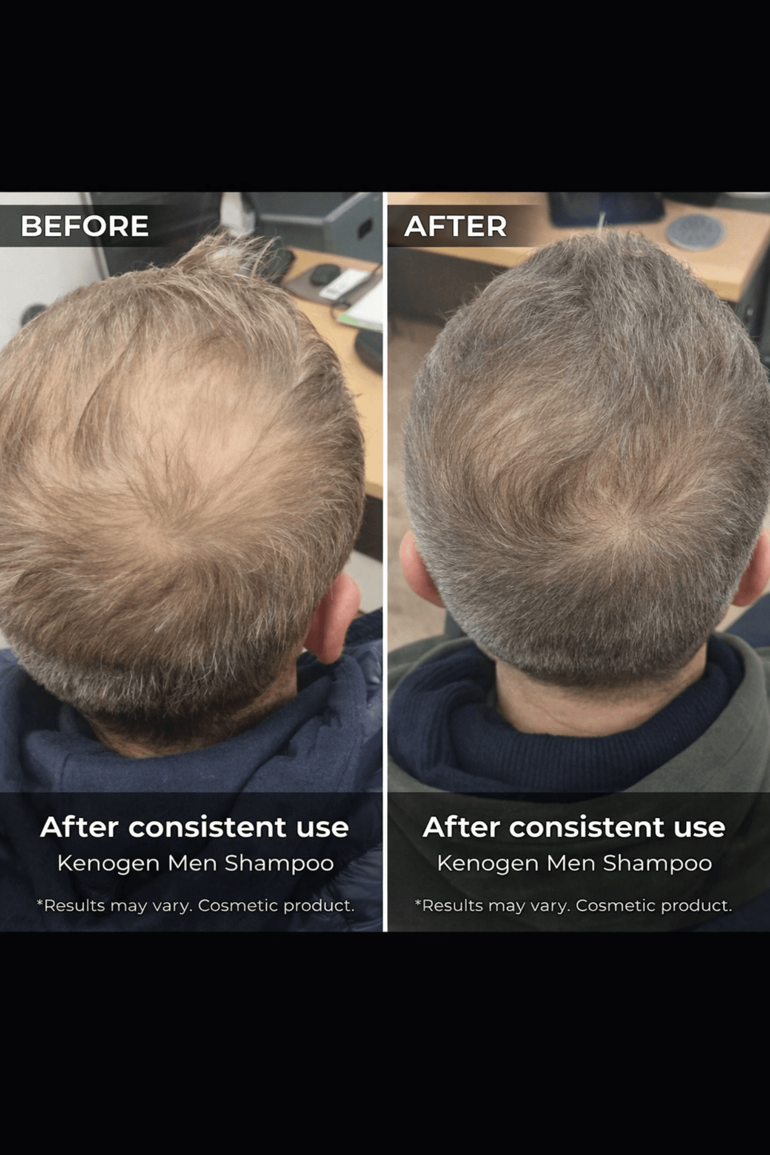 Kenogen Men’s Shampoo – Melatonin Formula for Hair Growth - My Hair Science