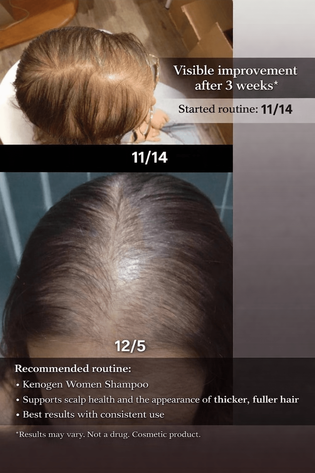 Kenogen Men’s Shampoo – Melatonin Formula for Hair Growth - My Hair Science