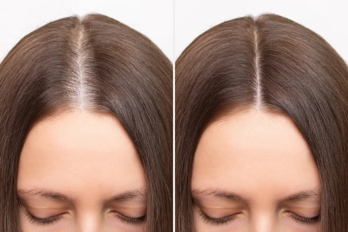 Women's Gray Hair & Scalp Strength Kit - My Hair Science