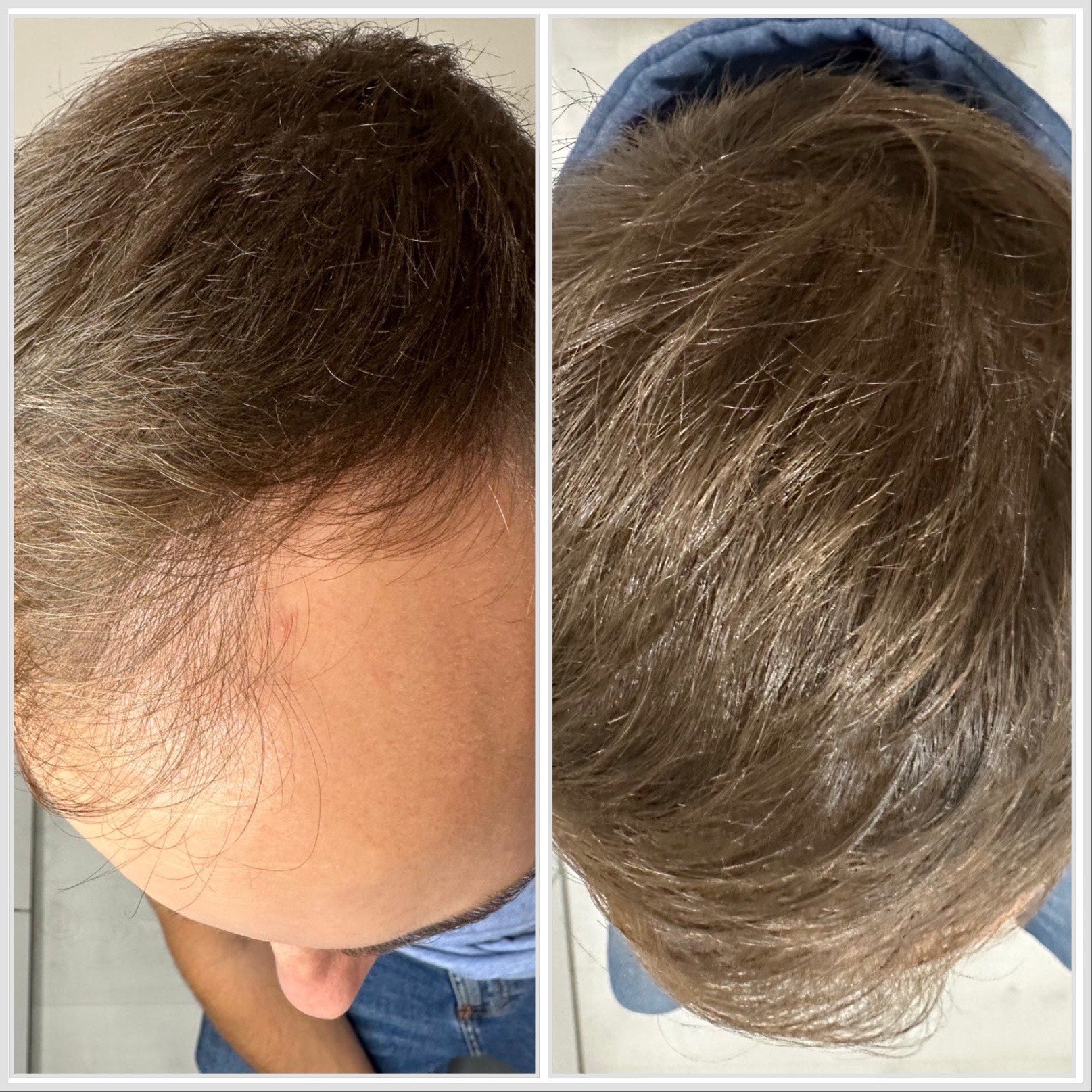 Kenogen Men customer hair result