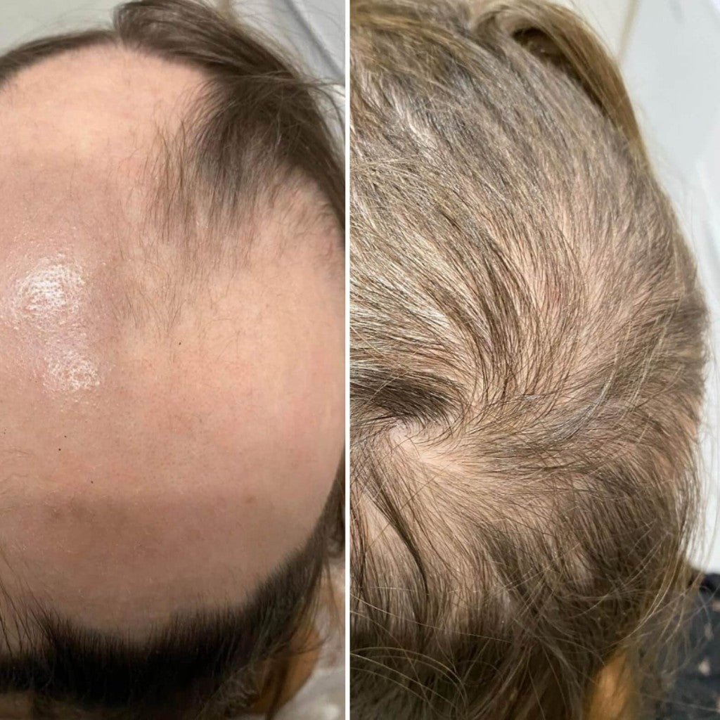 Kenogen Men before-and-after customer result