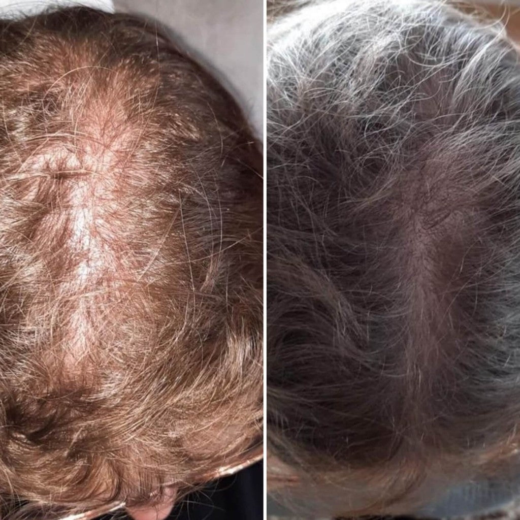 Kenogen Women before-and-after customer result